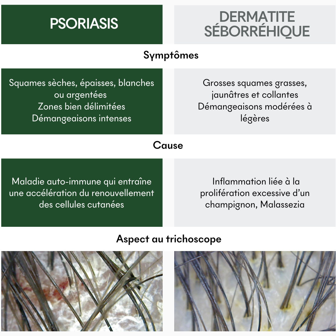 Complément SOS Squames Grasses