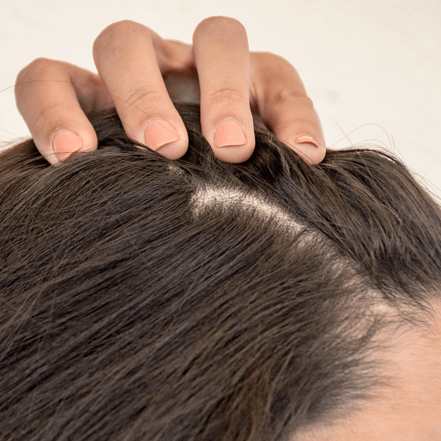Pourquoi j'ai les cheveux gras ? - MakeMyMask