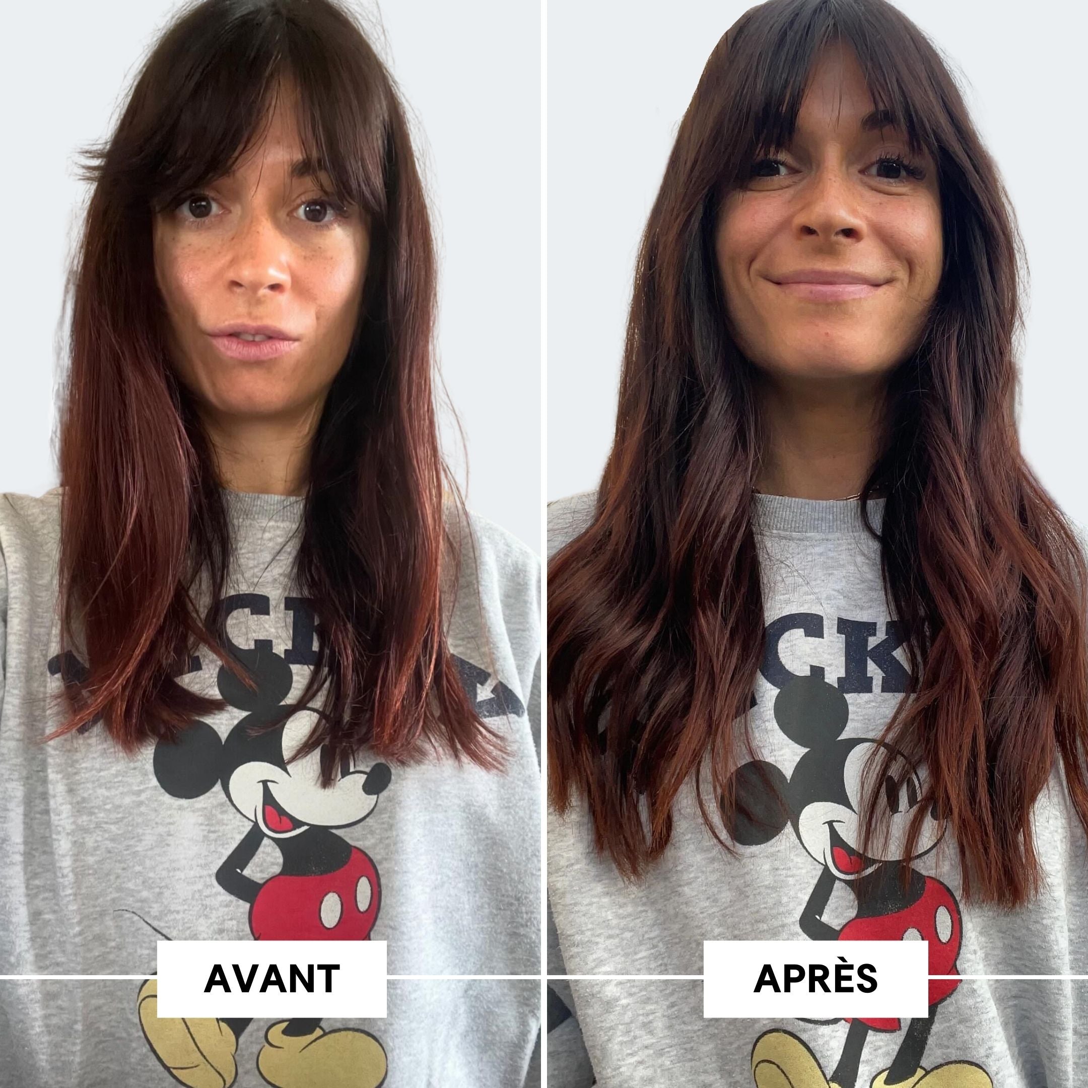 Avant après Chute de cheveux 