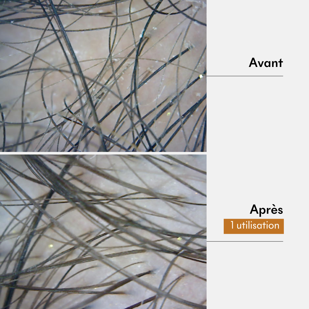 Résultat masque cheveux fins