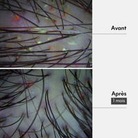 Protocole Détox Cheveux gras