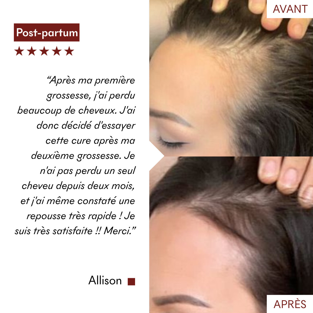 Gommage Actif Anti-Chute & Pousse