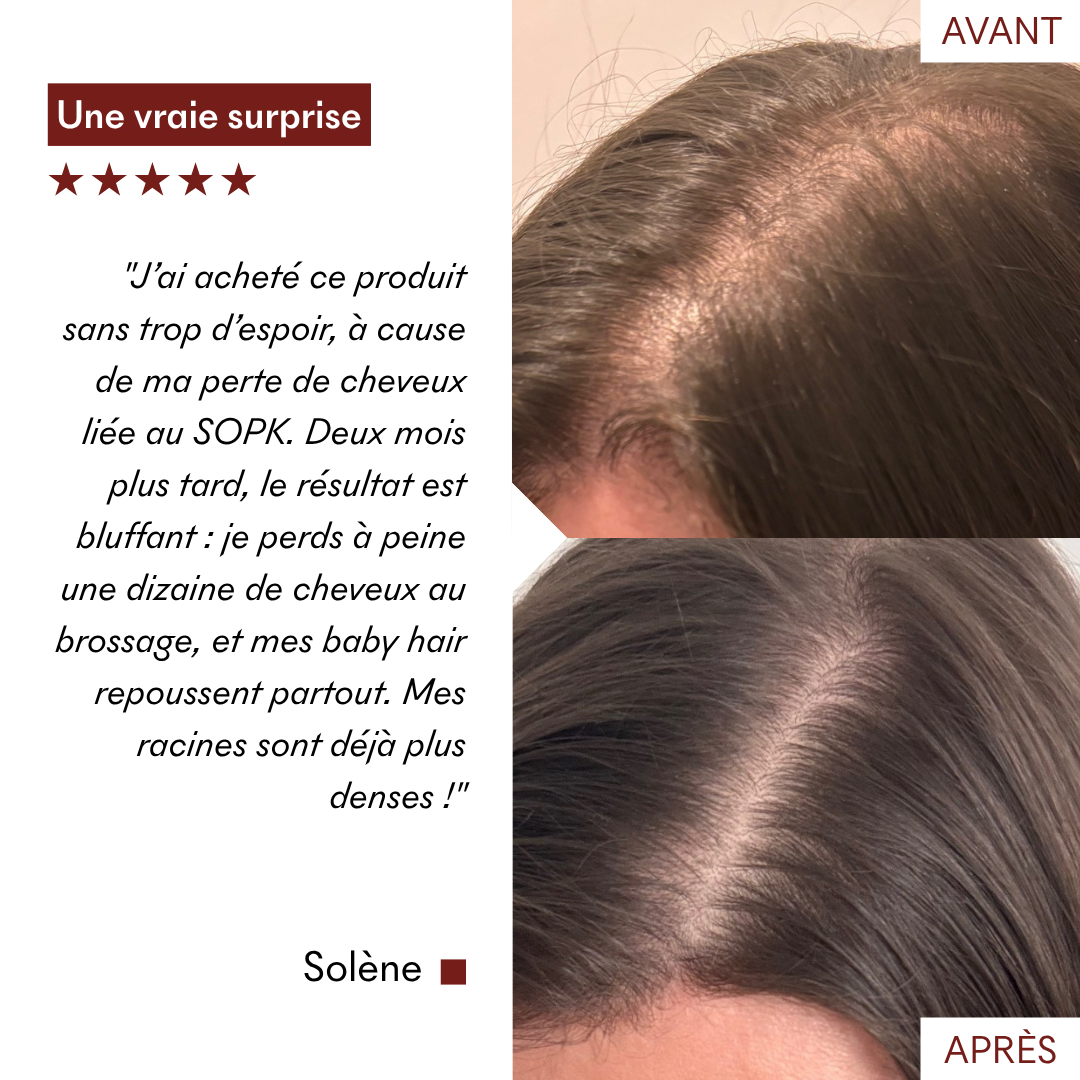 Gommage Actif Anti-Chute & Pousse