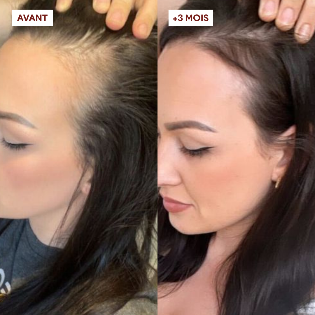 OFFRE 2 Gommages Anti-Chute = 1 Shampoing offert