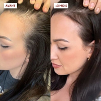 OFFRE 2 Gommages Anti-Chute = 1 Shampoing offert