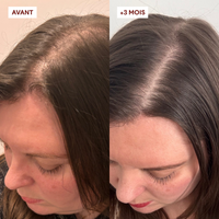 OFFRE 2 Gommages Anti-Chute = 1 Shampoing offert