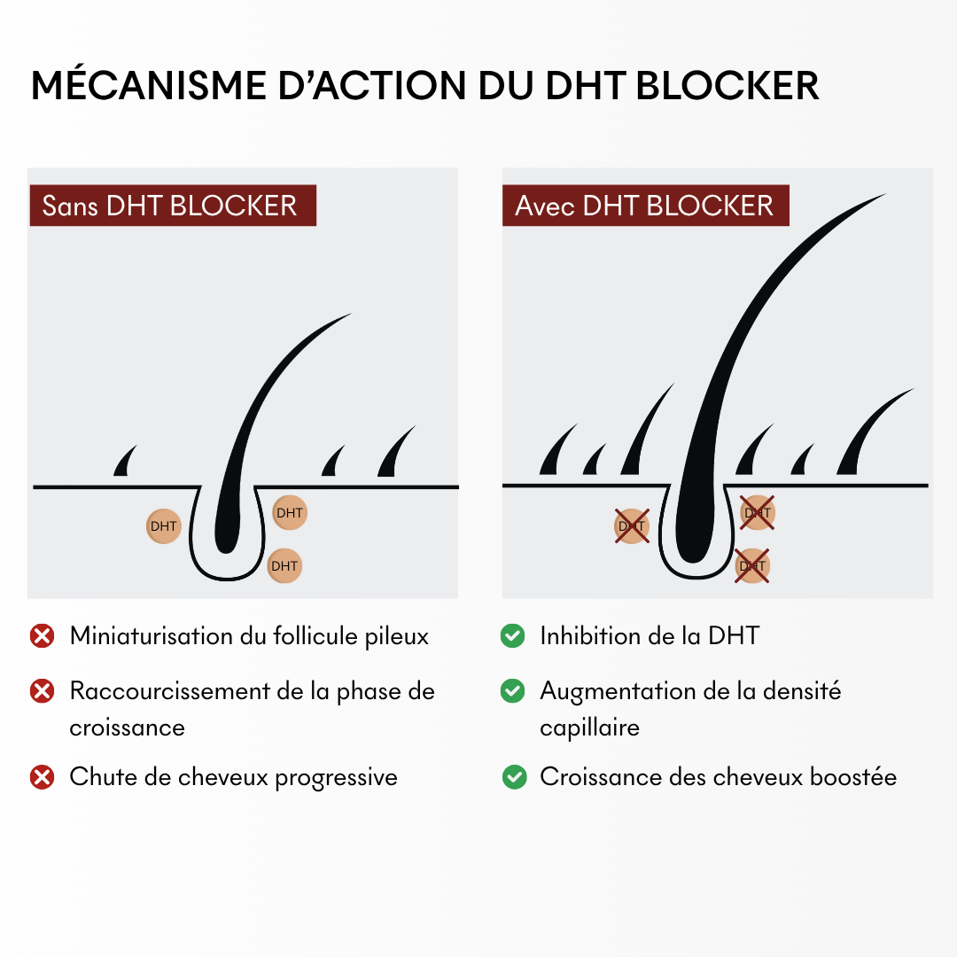DHT Blocker Anti-Chute Hormonale