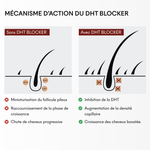 DHT Blocker Anti-Chute Hormonale