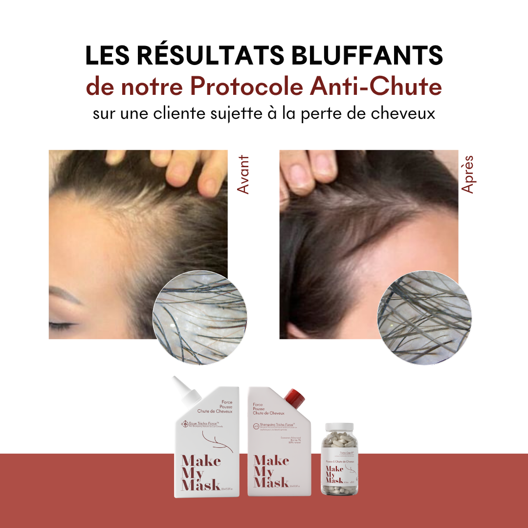 Protocole Anti-Chute Réactionnelle