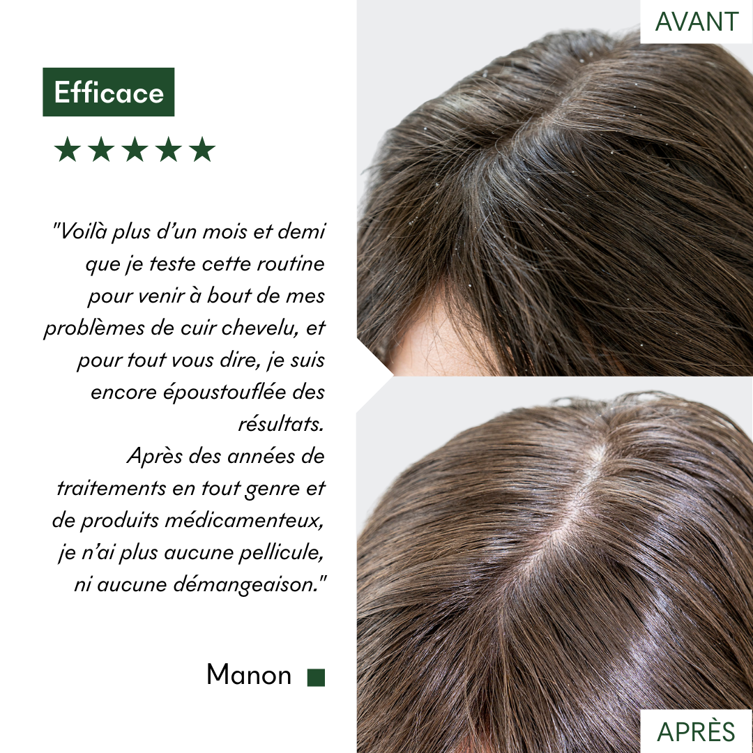 Masques Anti-Pelliculaires en poudre