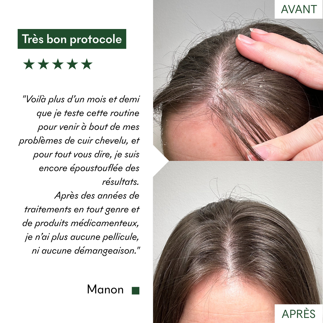 Masques Anti-Pelliculaires en poudre