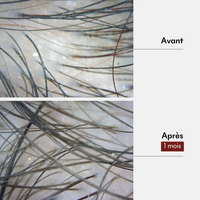 Gommage Actif Anti-Chute & Pousse