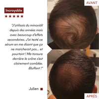 Sérum Anti-Chute Tricho-Boost