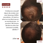 Mallette Post-Greffe/PRP