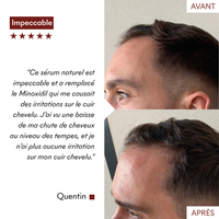 Protocole Anti-Chute Hormonale