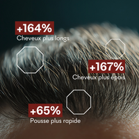 Protocole Anti-Chute Hormonale